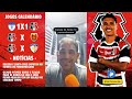 🇾🇪🔥minha nossa veja o que falou o vibrante sobre o empate do santa cruz contra o decisÃo