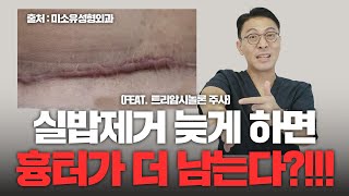 279화. 실밥제거 늦게하면 흉터가 더 크게 남는다?