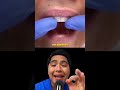 sin muelas mira esto #dientes #dentista #tips #parati #viral #fyp #shorts #shortvideo #fypシ