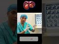 লিভার ক্যান্সারের চারটি কারণ primary liver tumor dr.mustafizur rahman