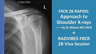 FRCR RAPIDS Shoulder approach (Dr Mitesh) + RadVibes  FRCR 2b sessions: May 21 2023