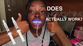 NOVASHINE TEETH WHITENING REVIEW | whiter teeth in 5 days!