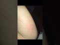 My first spider bite 🕷.                  #shorts #short #shortvideo #spider #youtubeshorts