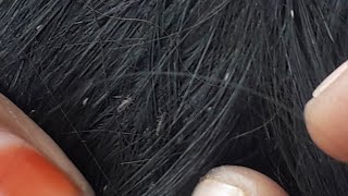 short black hair Nitpicking @PR Nitpicking channel