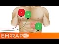 Double Sequential Defibrillation