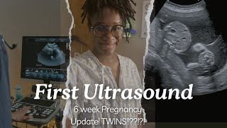 6 WEEK PREGNANCY UPDATE  | OUR FIRST ULTRASOUND FOR BABY # 4 |  ARE WE HAVING TWINS IDK ?!?! SHOCKED