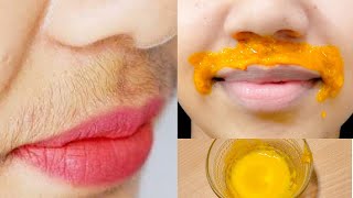 होठों के ऊपर के बाल Upper Lips Hair एक बार हटाने के बाद वापस कभी नहीं आएंगे | Facial Hair Treatment