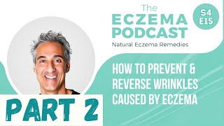 Internal \u0026 topical strategies to prevent/reverse wrinkles from eczema (Part 2) - The Eczema Podcast