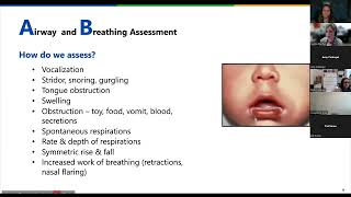 Paediatric Assessment When to Worry