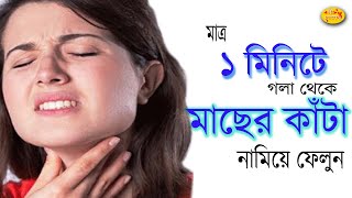 মাত্র ১ মিনিটে গলায় আটকে থাকা মাছের কাঁটা দূর করুন ঘরোয়া উপায়ে।Bangla Health Tips।Shree choroneshu