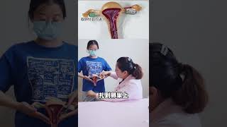 做试管是怎么取卵的你知道吗？ #医学科普 #关爱女性健康 #试管