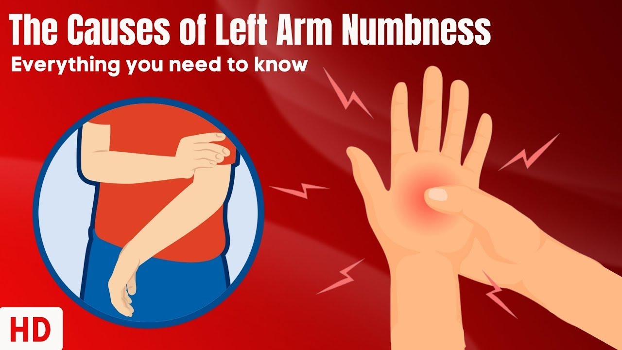 The Causes Of Left Arm Numbness - YouTube