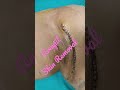 armpit skin excision