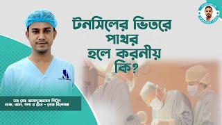 টনসিলের ভিতরে পাথর হলে করনীয় কি । Dr. Md. Assaduzzaman Liton