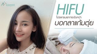 หน้าเรียวสวยด้วย HIFU  by ISSAVEE CLINIC