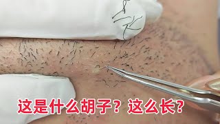 近距离看拔胡子！这是什么胡子？这么长？Watch beard plucking up close! What kind of beard is this? That long?