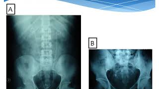 Urologic Investigations | urology | 6th grade | Dr. Islam Farouk