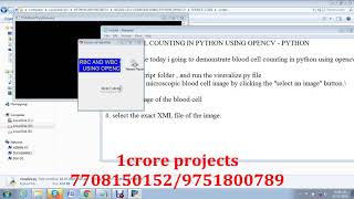 Blood Cell Counting Using Opencv Python - 1Crore Projects