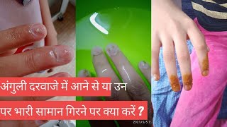 अंगुली दरवाजे में आने से  या उन पर भारी सामान गिरने पर क्या करें ? Crushed Finger Injury Treatment