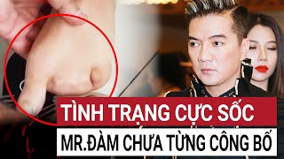 Tình trạng mới nhất của Đàm Vĩnh Hưng sau gần 1 năm gặp nạn, ai cũng sốc