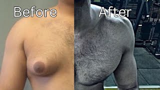 How to Get Rid of Chest Fat & Gynecomastia (Science Explained)