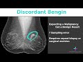 two minute techniques breast biopsy concordance