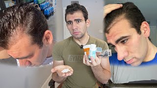 HOW I STOPPED MY HAIR LOSS!