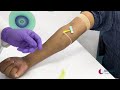 mastering blood draw for next generation sequencing sample collection guide onecell diagnostics