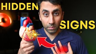 Doctor Explains Heart Attack Symptoms: 7 Warning Signs You Should NEVER Ignore! 🫀⚠️