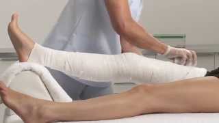 Plaster of Paris Knee Circular Cast Application