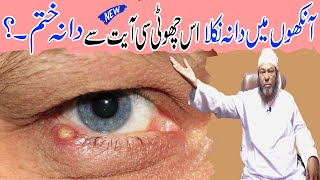 آنکھوں کے خارش کا علاج  کریں؟ | آنکھوں کا وظیفہ | آنکھوں کو ٹھیک کرنے کا طریقہ | آنکھ میں دانہ نکلے۔