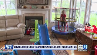 Jenison school leader: Must enforce chicken pox exclusion