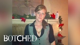 Sarah's Boobs Win the Complication Lottery | Botched | E!