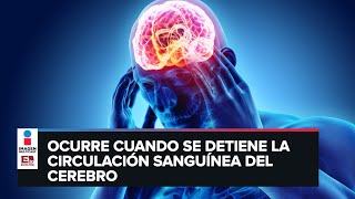 Infarto cerebral: Síntomas para detectarlo y causas