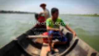 Life after Leprosy in Cambodia - Part 2:Thy's story