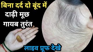 सिर्फ 2 मिनट में 60 साल के आंटी के चेहरे से मोटे तीखे दाढ़ी,मूछ ऐसे निकला😱|| unwanted facial hair