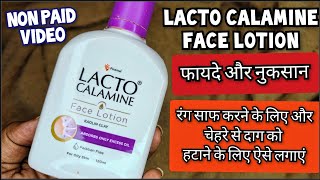 Lacto Calamine Face Lotion |लैक्टो कैलामाइन लोशन | How to use lacto calamine lotion |Review In Hindi