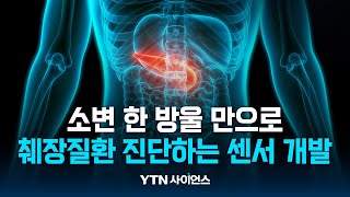 [과학뉴스] 국내연구진, 소변으로 췌장질환 감지하는 고감도 센서 개발 / 23.08.14