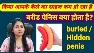 Penis का साइज अचानक छोटा होता जा रहा है? बरीड पेनिस (buried penis) क्या होता है?