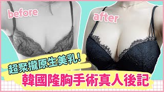 超聚攏原生美乳 韓國隆胸手術真人後記  ｜韓國必嫵整形醫院View Plastic Surgery