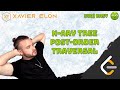 LeetCode 590 | N-ary Tree Postorder Traversal