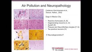 Brain Health and Air Pollution.