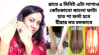 শীতে কোঁচকানো ফাটা কালো হাত পা হীরার মত চমকাবে/Hand Feet Whitening Facial /SkinGlowing