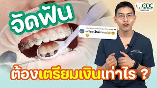 จัดฟันต้องเตรียมเงินเท่าไหร่