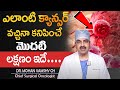 ఒంట్లో కాన్సర్ కణాలు ఉంటె కనిపించే సూచనలు || Dr.Mohan Vamsi About Cancer | SumanTV Health care