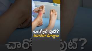 చార్కోట్ ఫుట్? | కారణాలు, లక్షణాలు మరియు చికిత్సలు | Dr. Venu Kavarthapu