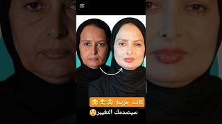 سيصدمك التغيير لن تصدق النهاية تغيير كلي في الوجه #makeup #beauty #hairstyle #love #اكسبلور #hair #