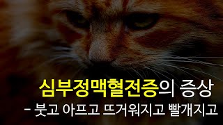 심부정맥혈전증(DVT)의 증상