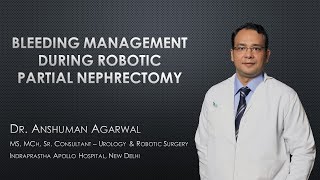 Bleeding management during Robotic Partial Nephrectomy by Dr Anshuman Agarwal, Apollo Hospital