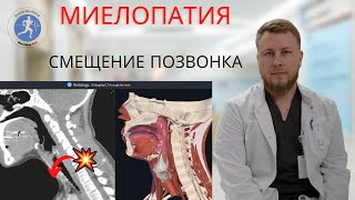 Миелопатия | разбор МРТ